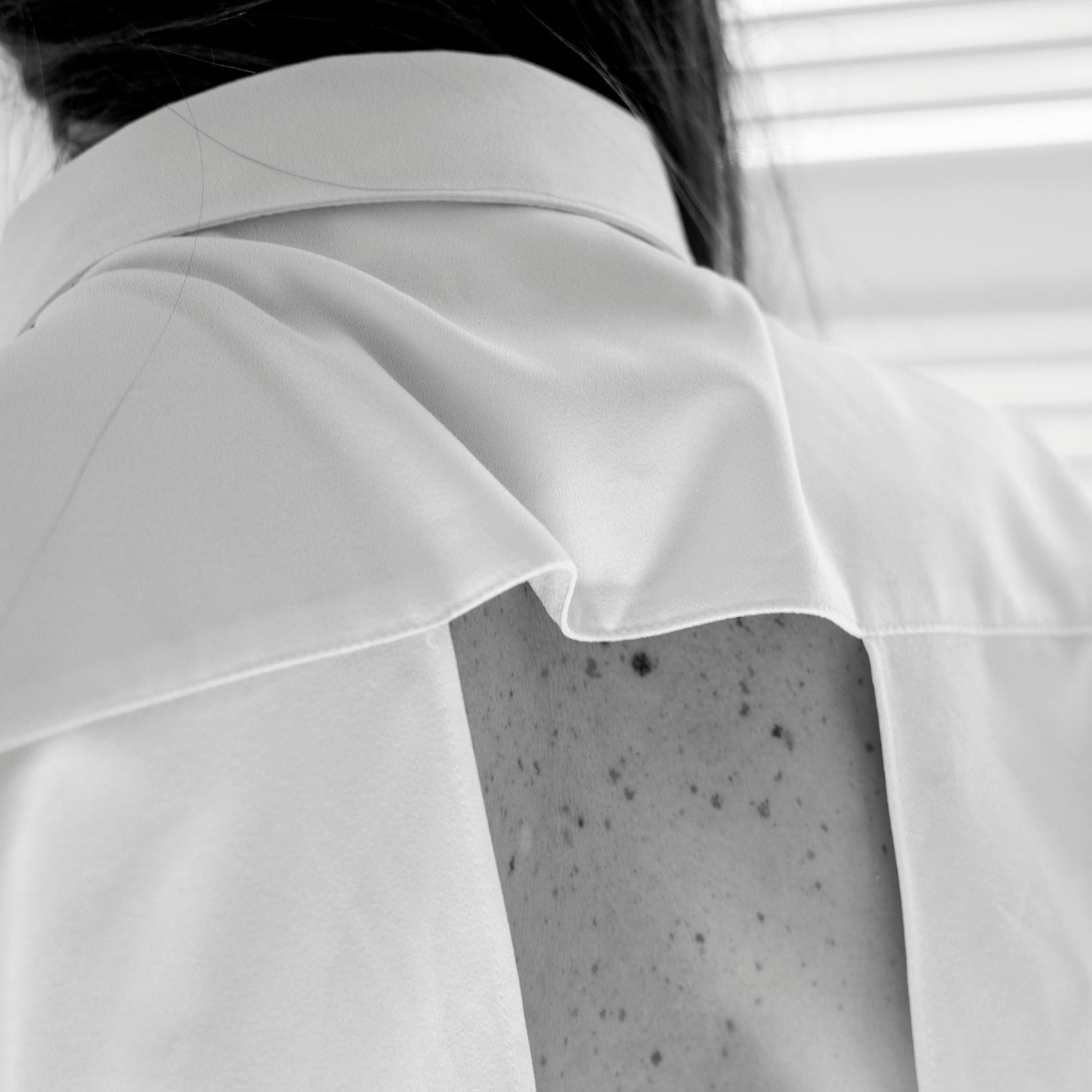 Black and white close-up of a woman's back wearing a backless white dress with visible freckles.